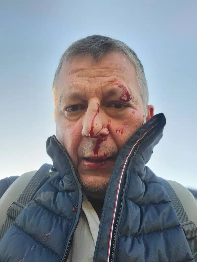 Kais Sturz auf der Via de la Plata